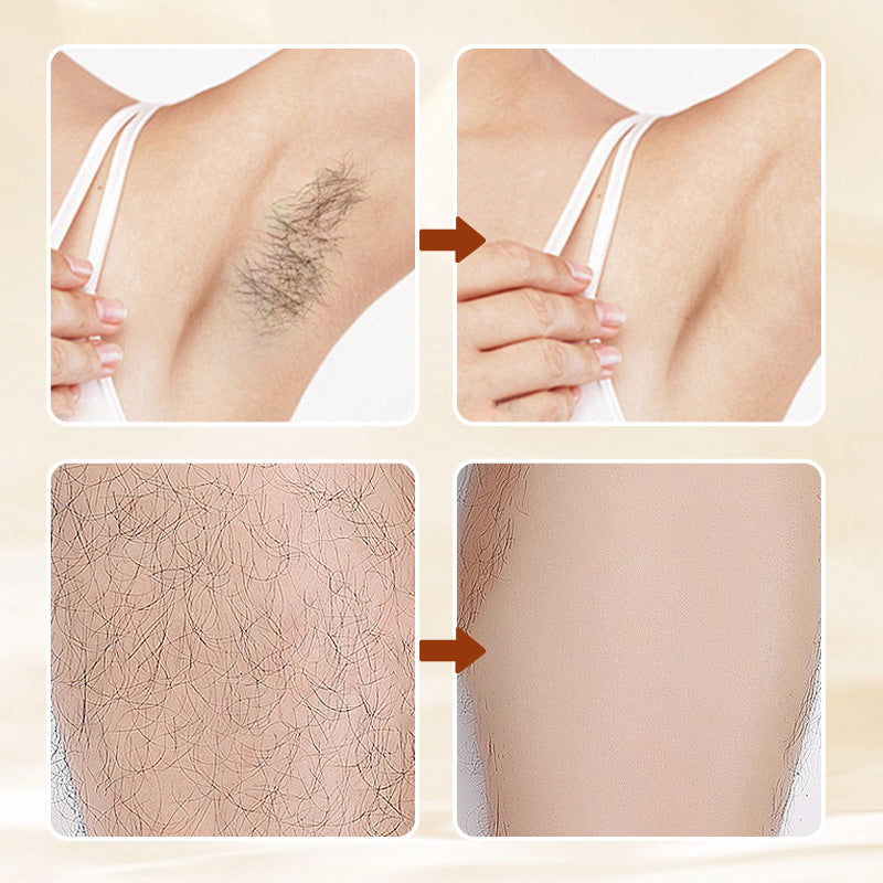 Hair Removal Cream for Silky Smooth Skin – Gentle & Fast-Acting