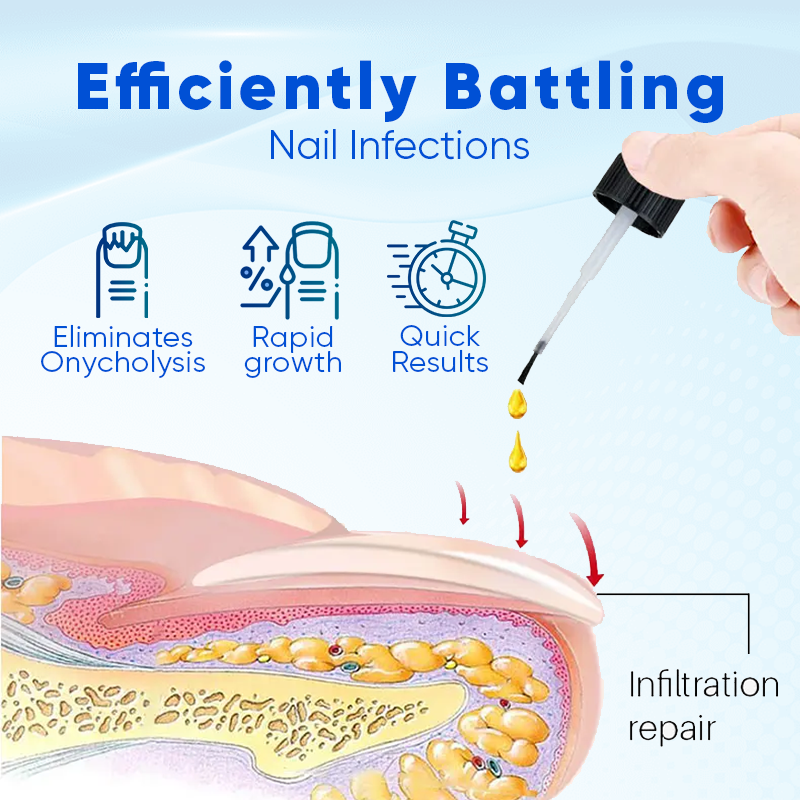 Biancat™ – OnyxoGuard Nail Serum for Strong, Healthy & Protected Nails [1 + 1 Free]