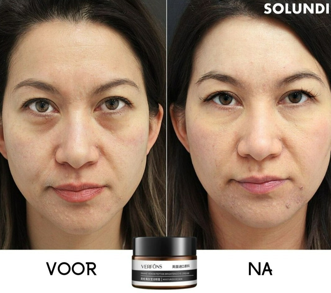 EyeRejuv™ – Astonishing Eye Cream for Radiant, Smooth & Youthful-Looking Skin [1 + 1 Free]