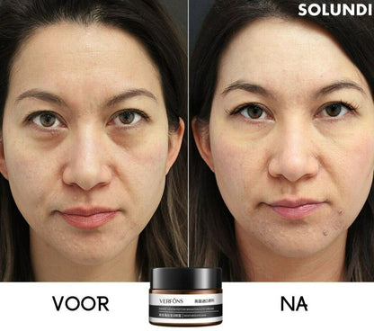 EyeRejuv™ – Astonishing Eye Cream for Radiant, Smooth & Youthful-Looking Skin [1 + 1 Free]
