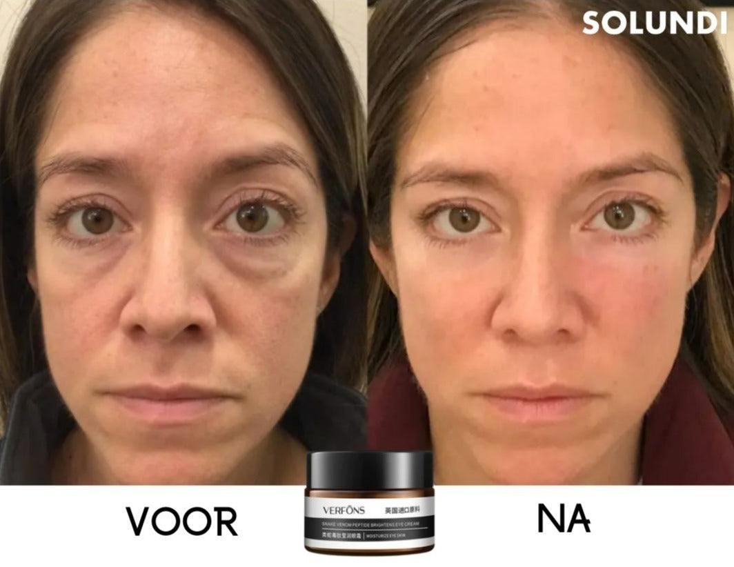 EyeRejuv™ – Astonishing Eye Cream for Radiant, Smooth & Youthful-Looking Skin [1 + 1 Free]