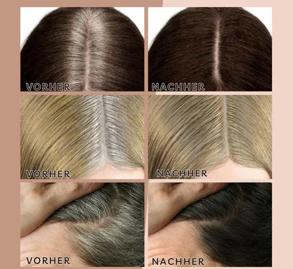 BeGlam™ – Waterproof Hair Powder for Instant Volume, Dense Appearance & Natural Look [50% Off]