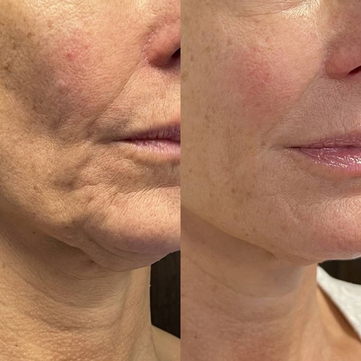 Nectare – Anti-Aging Serum Stick for Visibly Younger Skin [50% Off]
