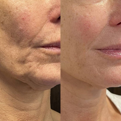 Nectare – Anti-Aging Serum Stick for Visibly Younger Skin [50% Off]