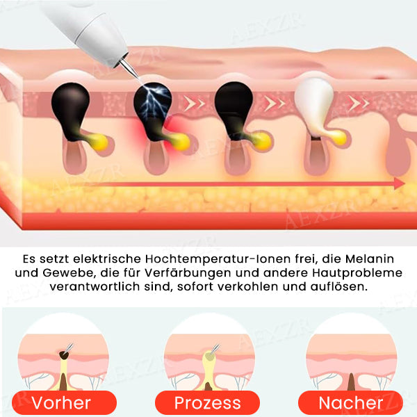 LuminSkin™ - Say goodbye to skin imperfections [50% Off]