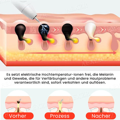 LuminSkin™ - Say goodbye to skin imperfections [50% Off]