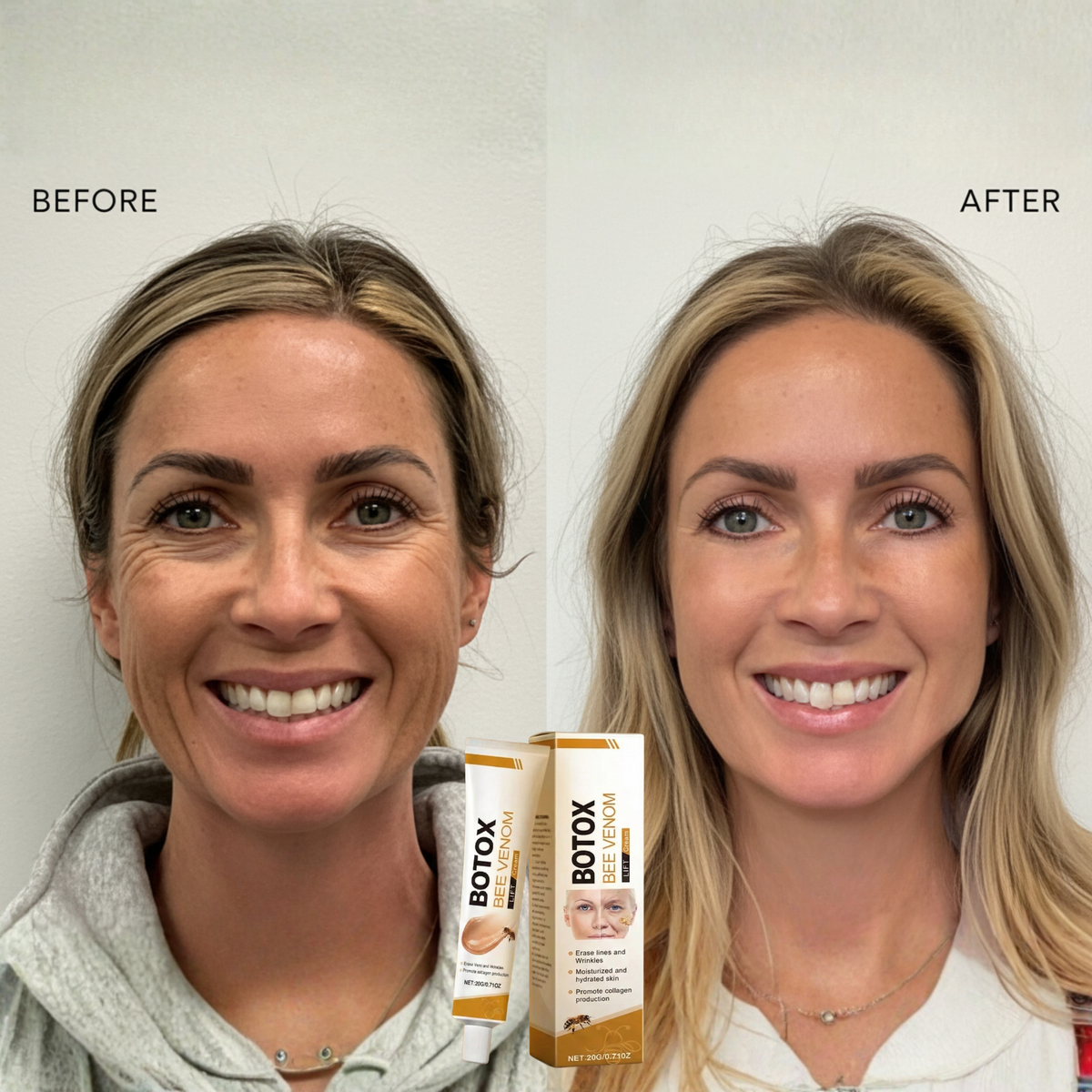 Bee Venom Anti-Aging Face & Neck Cream for Firmer Youthful Skin