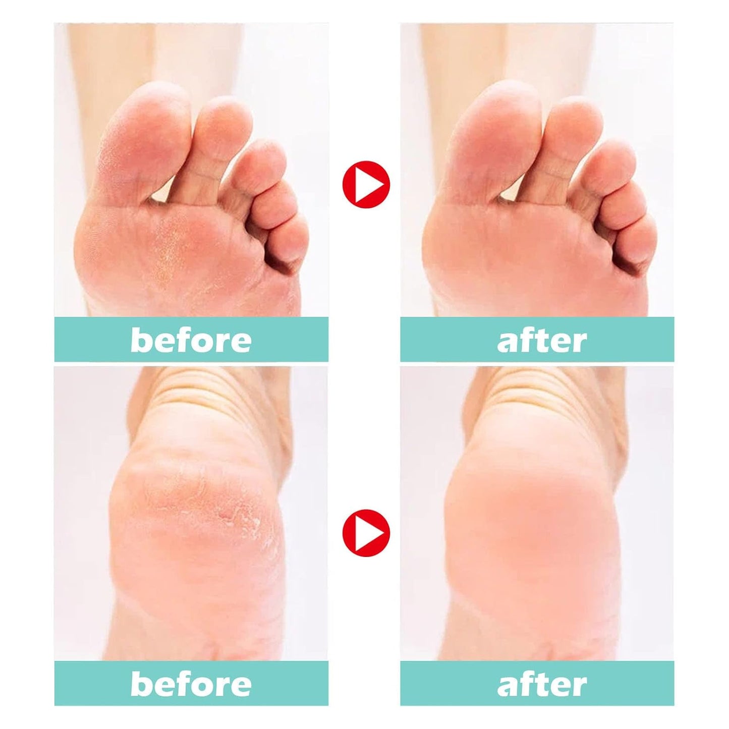 1+1 FREE | Medical Foot Care Cream™ — Heals and protects cracked skin for lasting comfort