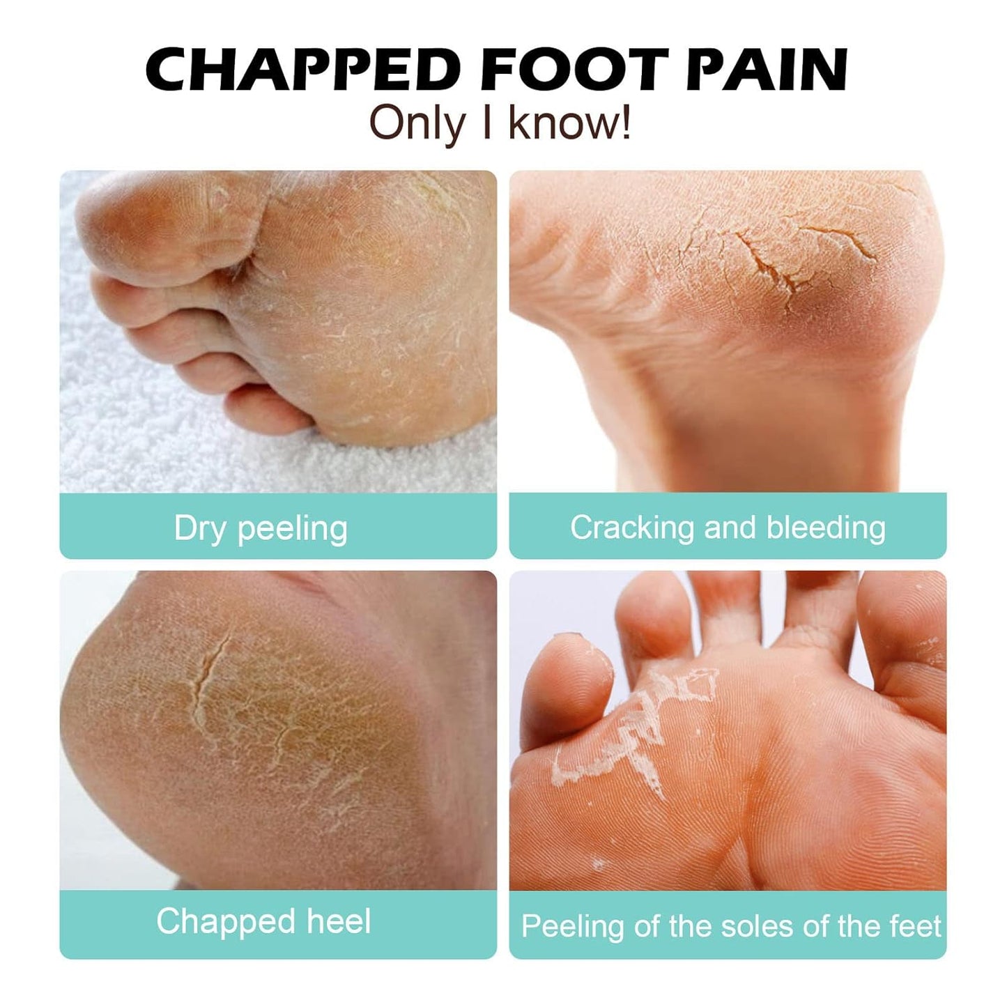 1+1 FREE | Medical Foot Care Cream™ — Heals and protects cracked skin for lasting comfort