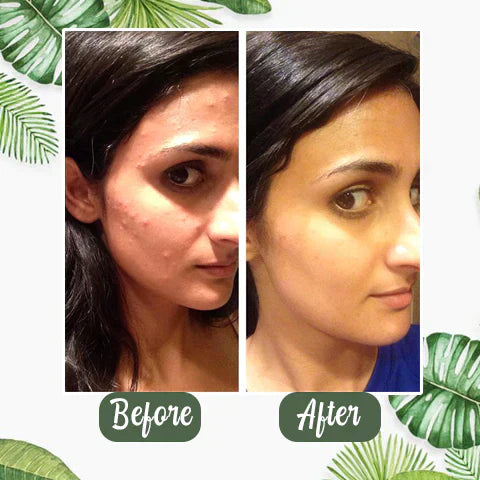 1+1 FREE | Poreless Deep Cleanse Mask Stick™ — Reveals fresh, radiant skin without blackheads and shine