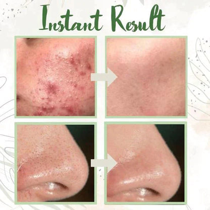 1+1 FREE | Poreless Deep Cleanse Mask Stick™ — Reveals fresh, radiant skin without blackheads and shine