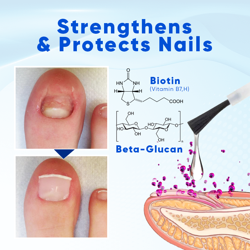 Biancat™ – OnyxoGuard Nail Serum For Hydration And Protection Of Fragile Nails [Buy 1 Get 1 Free]