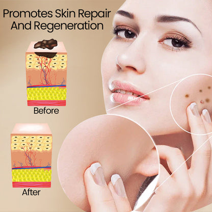 ClearSkin™ – Bee Venom Wart Removal Spray: Effective, Fast, and Gentle [50% Off]