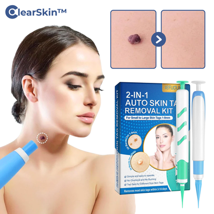 ClearSkin™ – Wart Removal Pen for Fast, Effective & Gentle Skin Treatment [50% Off]