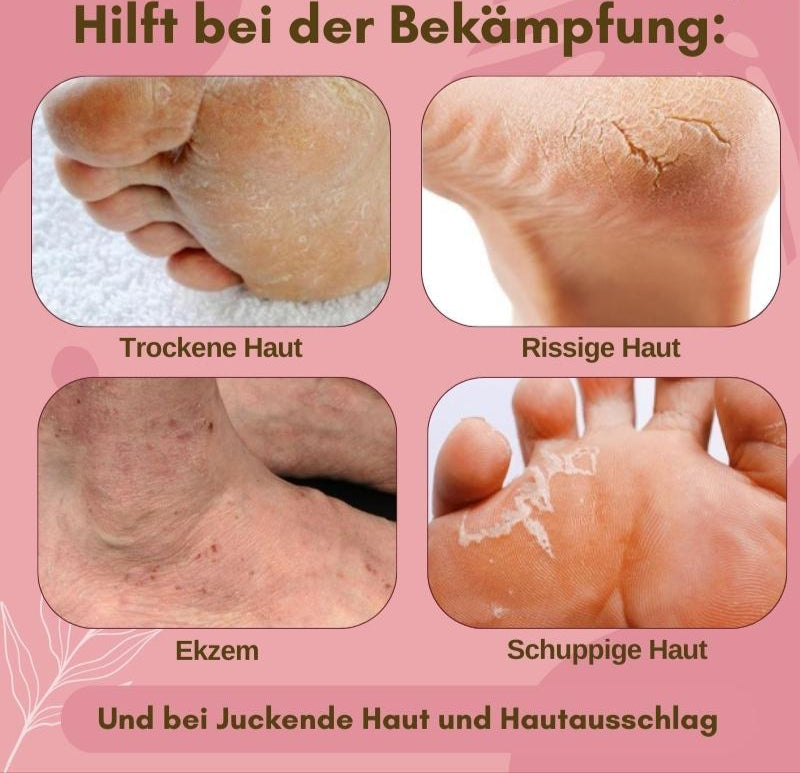 SolereJuve™ – Instant Foot Care for Smooth and Relaxed Feet [1 + 1 Free]