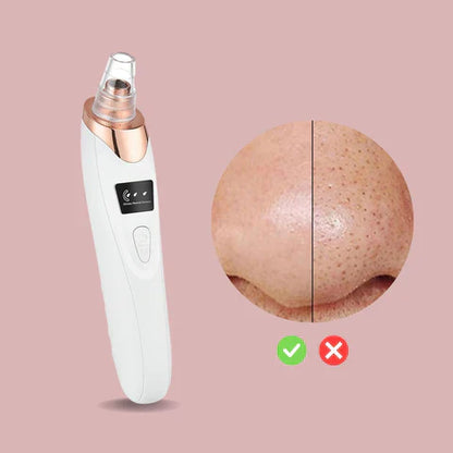 SkinClear™ – Finally Clear, Flawless Skin: Blemish-Free, Fresh, and Radiant [50% Off]