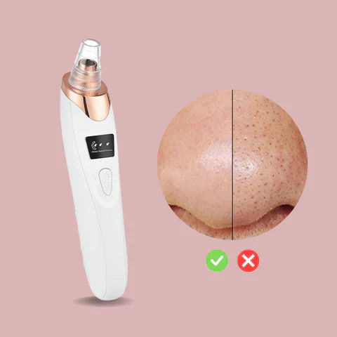 SkinClear™ – Finally Clear, Flawless Skin: Blemish-Free, Fresh, and Radiant [50% Off]