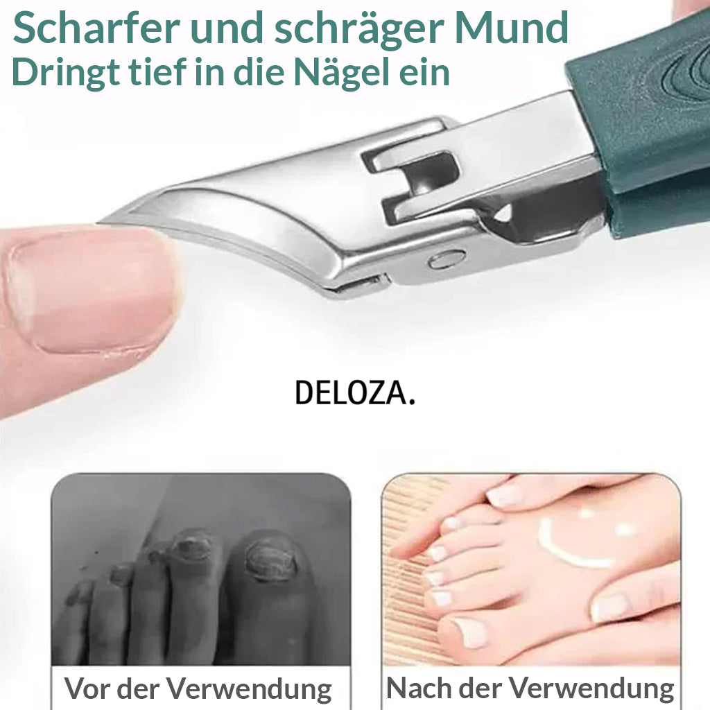 NailEase™ – 3-Piece Ingrown Toenail Care Set [50% Off]