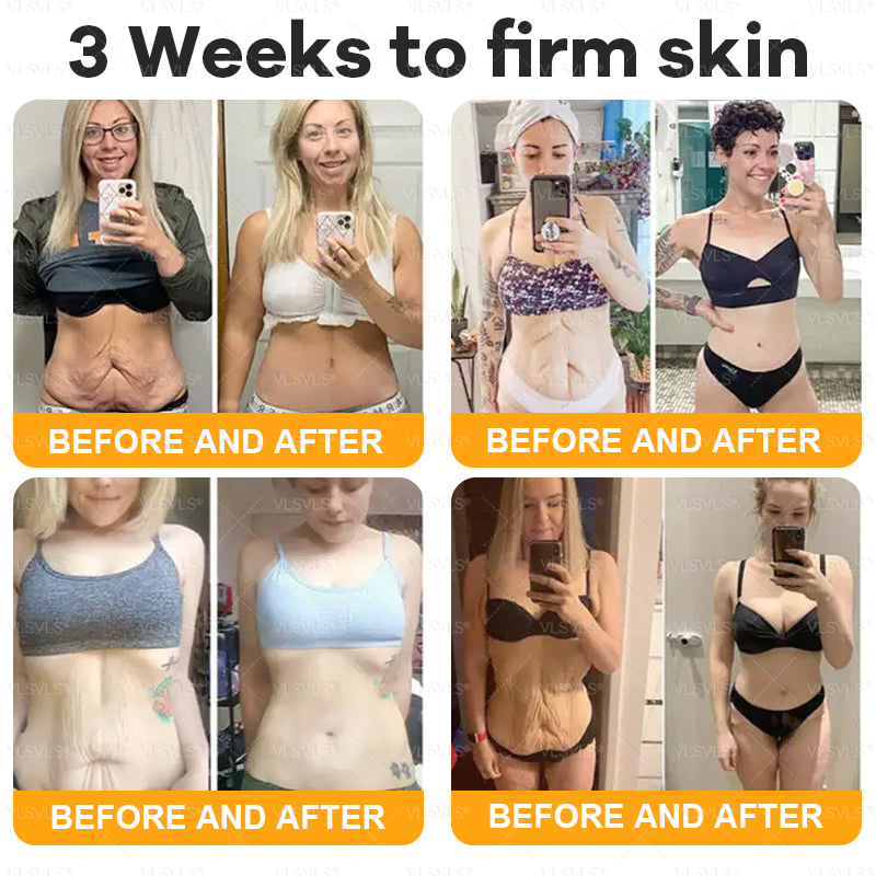 AgeGlow™ – Firming Anti-Aging Cream with Bee Venom Peptides [1 + 1 Free]