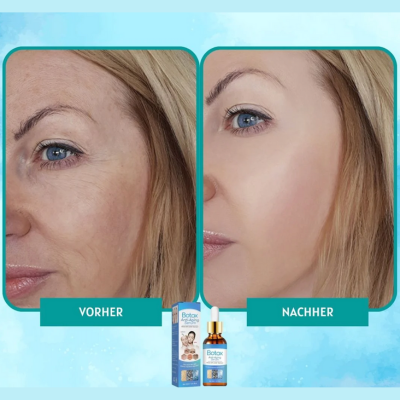Anti-Aging Serum for Wrinkle Reduction & Radiant Skin – 30ml