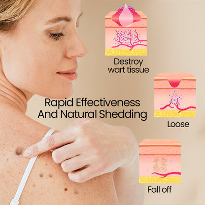 ClearSkin™ – Bee Venom Wart Removal Spray: Effective, Fast, and Gentle [50% Off]