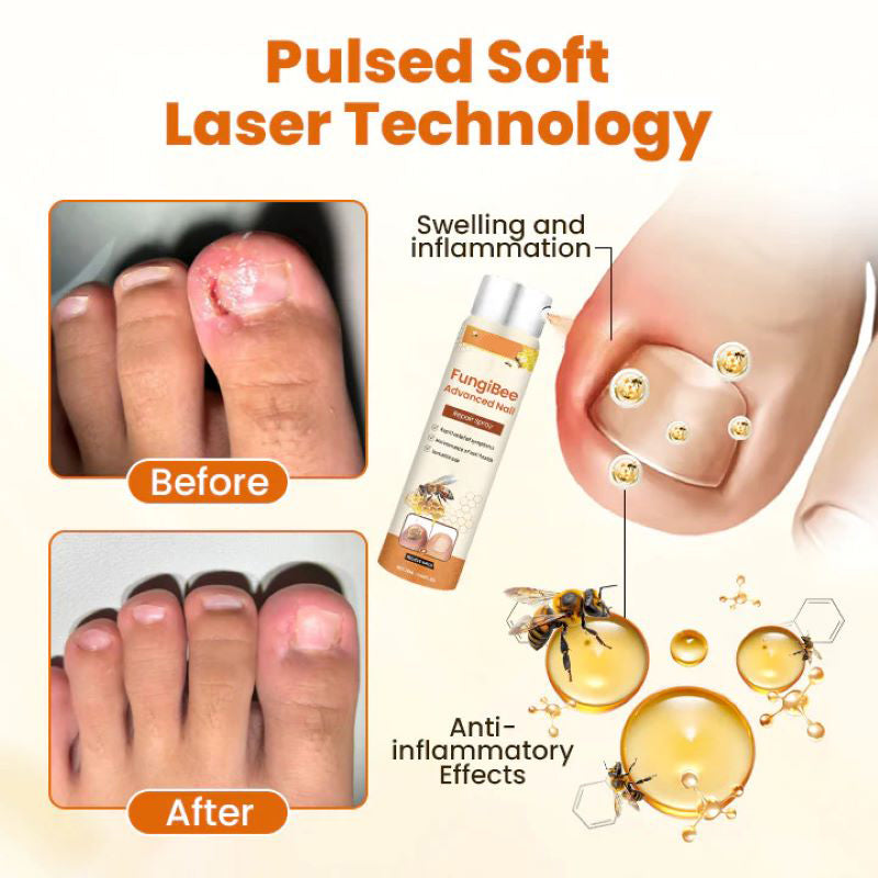 Bee Venom Nail Care Spray for Strong and Healthy Nails