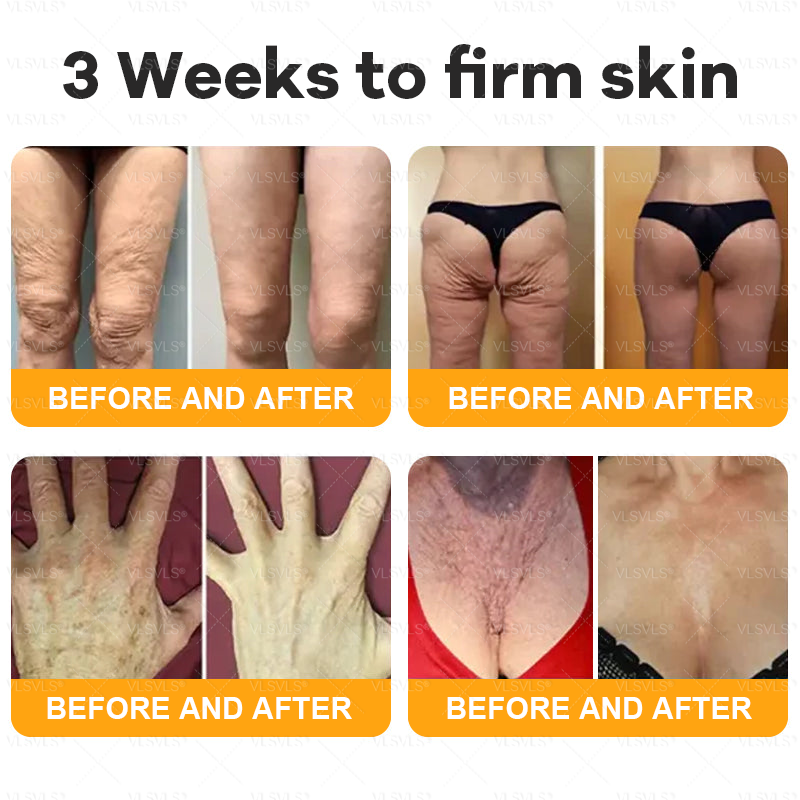 AgeGlow™ – Firming Anti-Aging Cream with Bee Venom Peptides [1 + 1 Free]