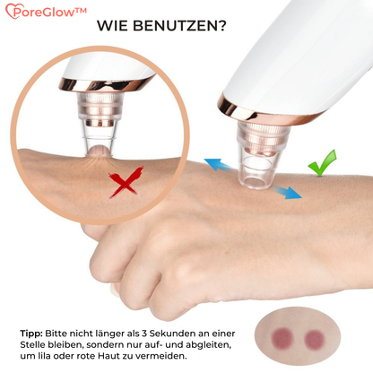 PoreGlow™ – Blackhead Removal Set for Thorough and Effective Skin Cleansing [50% Discount]