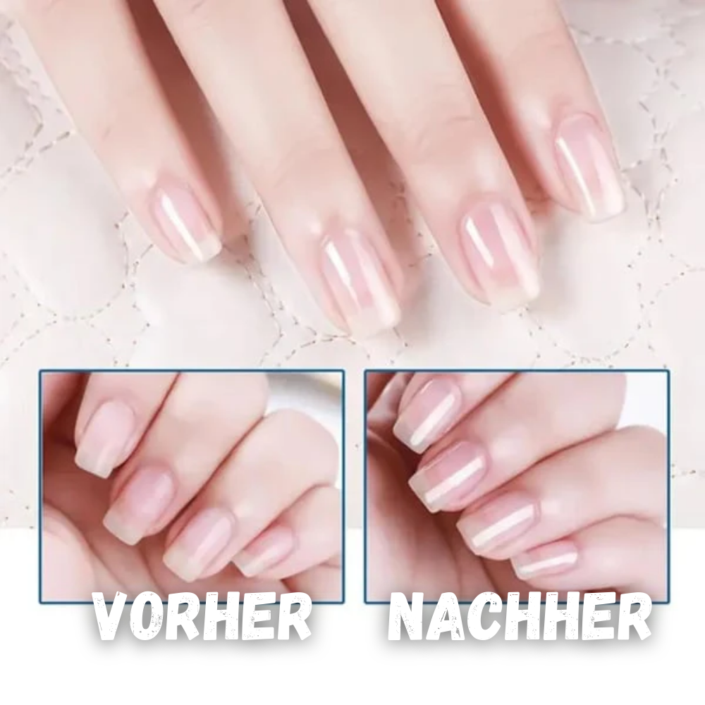 Nourishing Nail Care Oil for Healthy Shiny Nails & Cuticles