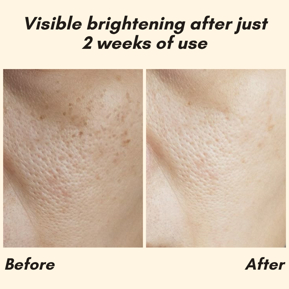 Vitamin C Serum for Face, Hands & Body – Radiant Skin Care