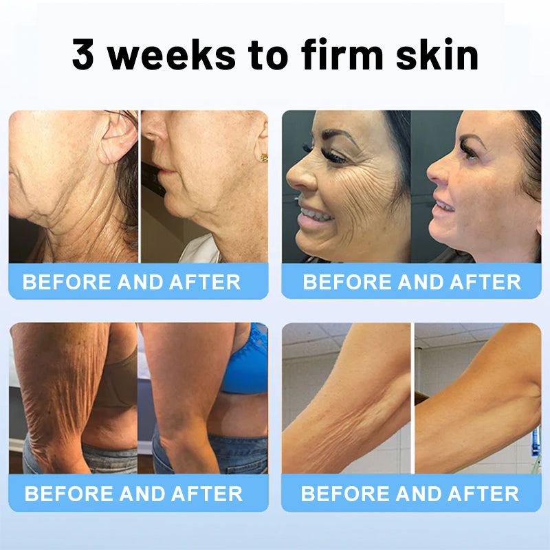 Venomea™ – Luxurious Lifting Stick with Bee Venom & Peptides for Firm, Youthful Skin [50% Off]