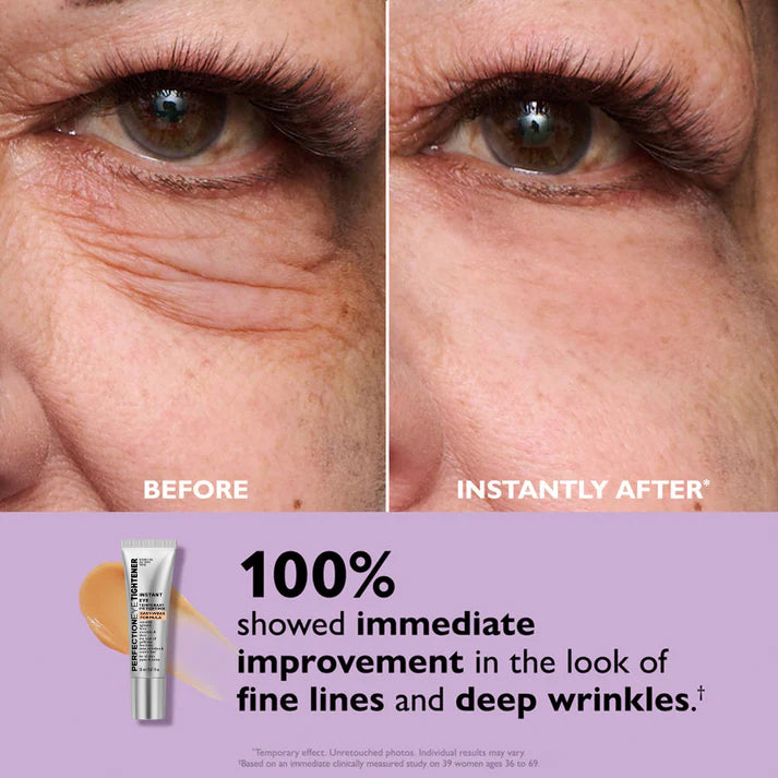 DermaLift™ – Instantly reduce puffiness & reveal youthful-looking eyes [50% Off]