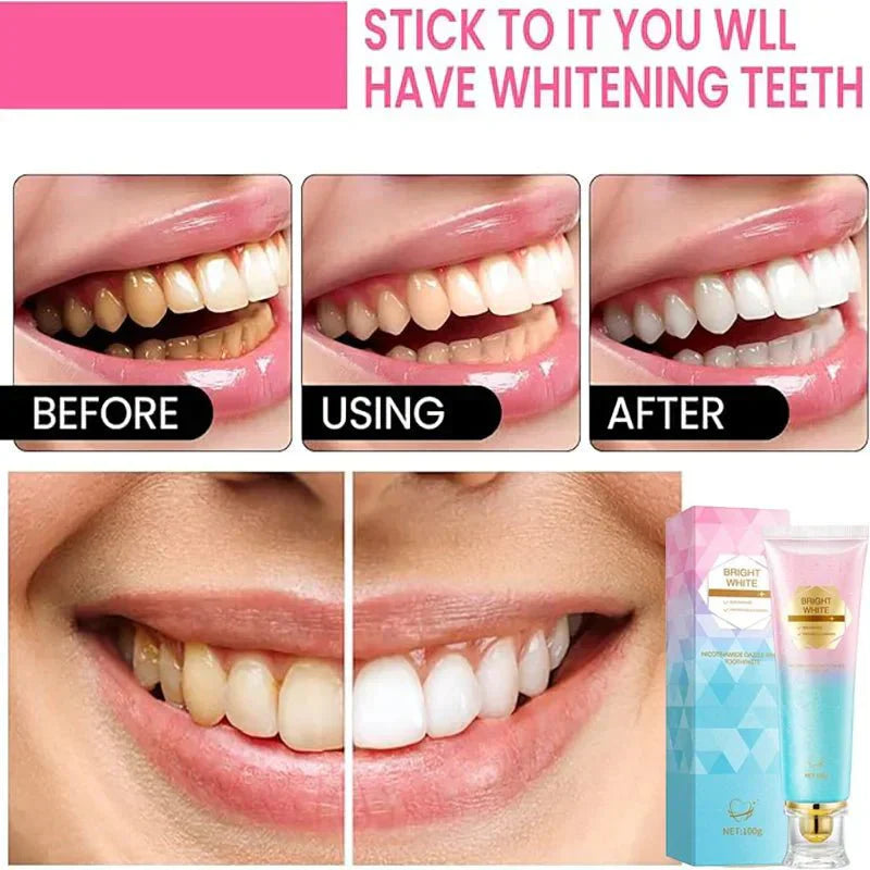 Probiotic Teeth Whitening Toothpaste – Gentle Stain Removal Formula