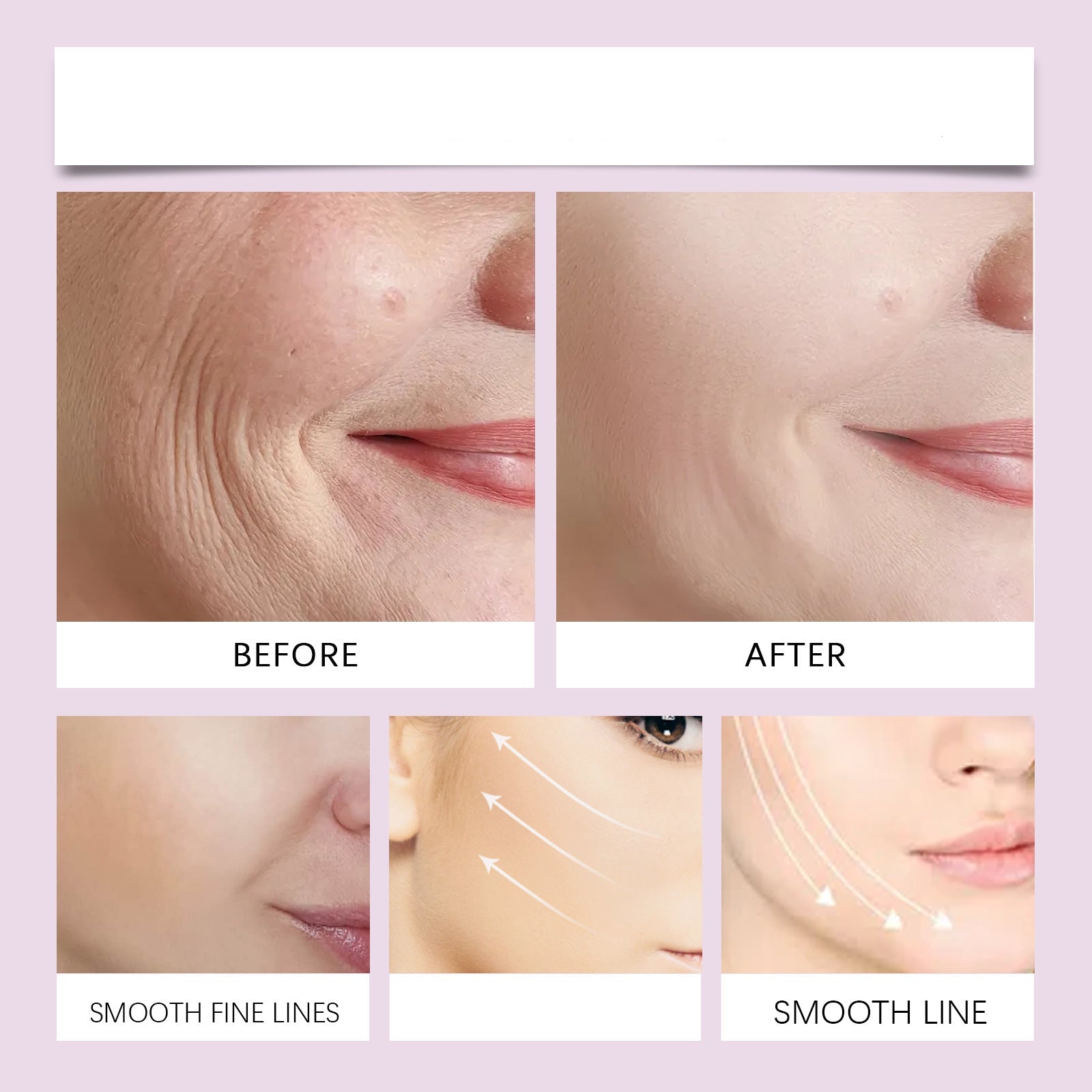 LuxLift™ – Lifts your chin and gives youthful radiance in seconds [50% Off]