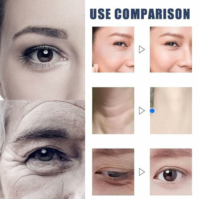 DermalDeep™ – Instantly fills deep wrinkles, visibly smoothing and youthful [50% off]