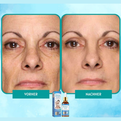 Anti-Aging Serum for Wrinkle Reduction & Radiant Skin – 30ml