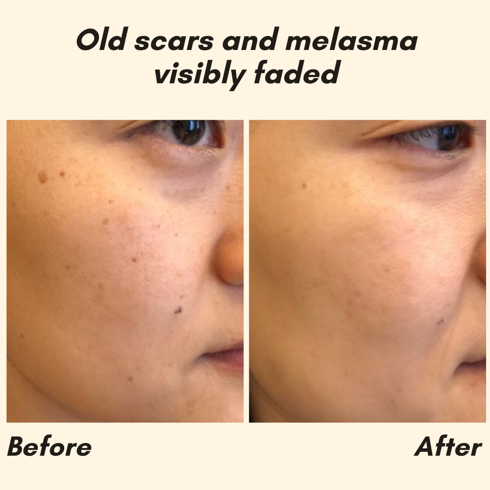 Vitamin C Serum for Face, Hands & Body – Radiant Skin Care