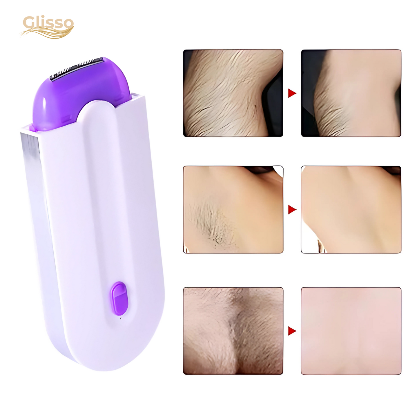 Glisso™ – Painless, Gentle Hair Remover for Silky Smooth and Well-Groomed Skin [50% Discount]