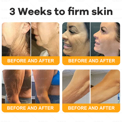 AgeGlow™ – Firming Anti-Aging Cream with Bee Venom Peptides [1 + 1 Free]