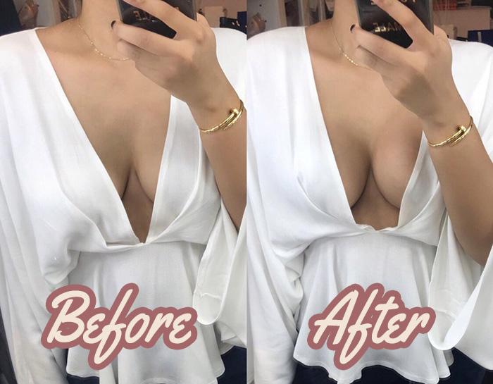 Collagen Breast Lifting Patches – Plant-Based Firming Skin Care
