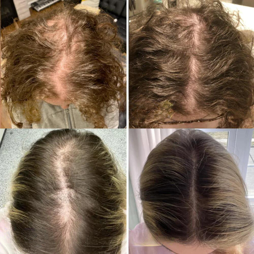 Natural Hair Growth Oil with 11 Plant Oils for Thicker, Fuller Hair