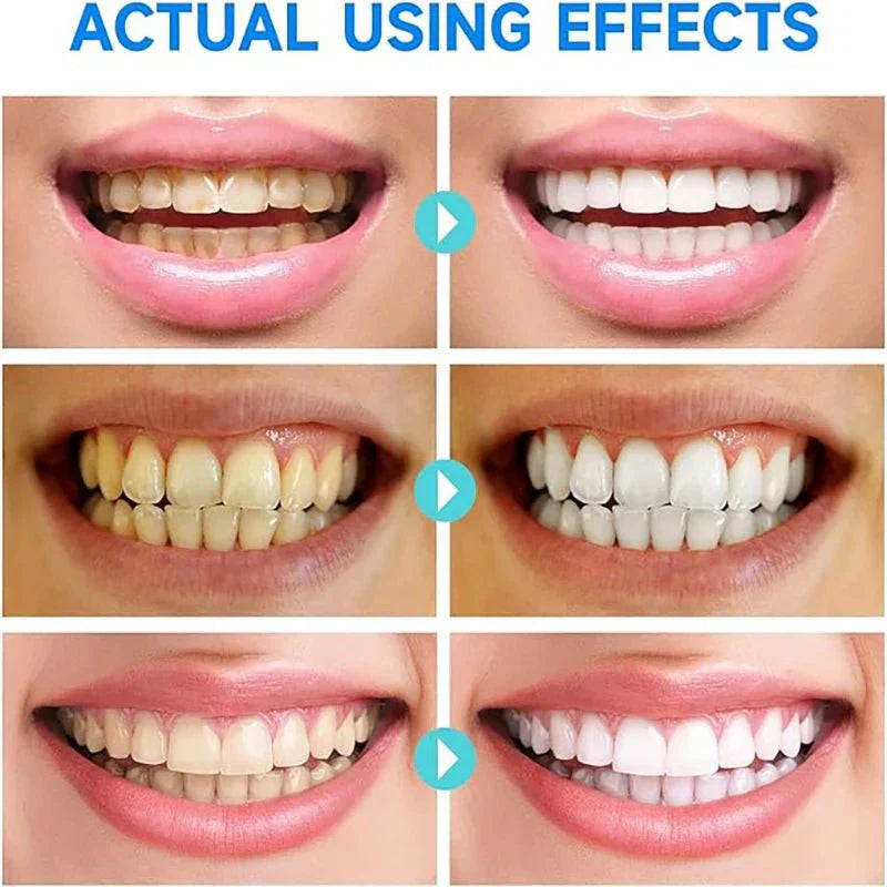 Probiotic Teeth Whitening Toothpaste – Gentle Stain Removal Formula