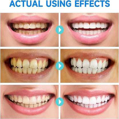 BrightMolto – Brilliantly white teeth in just 7 days [1 + 1 Free]