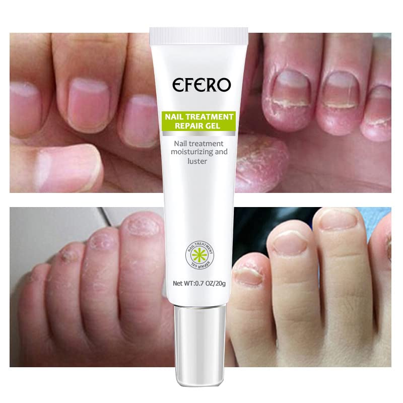 Nail Strengthening Gel for Brittle & Discoloured Nails – 2 Pack