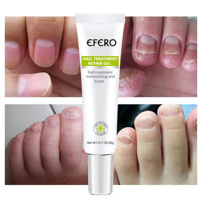 NailReborn – Nail Strengthening for Healthy and Beautiful Nails [1 + 1 Free]