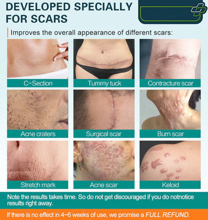ScarSpray™ – Soothes Irritated, Sensitive Skin Quickly and Effectively [50% Off]