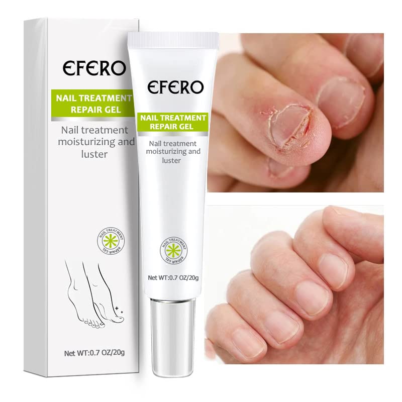 Nail Strengthening Gel for Brittle & Discoloured Nails – 2 Pack