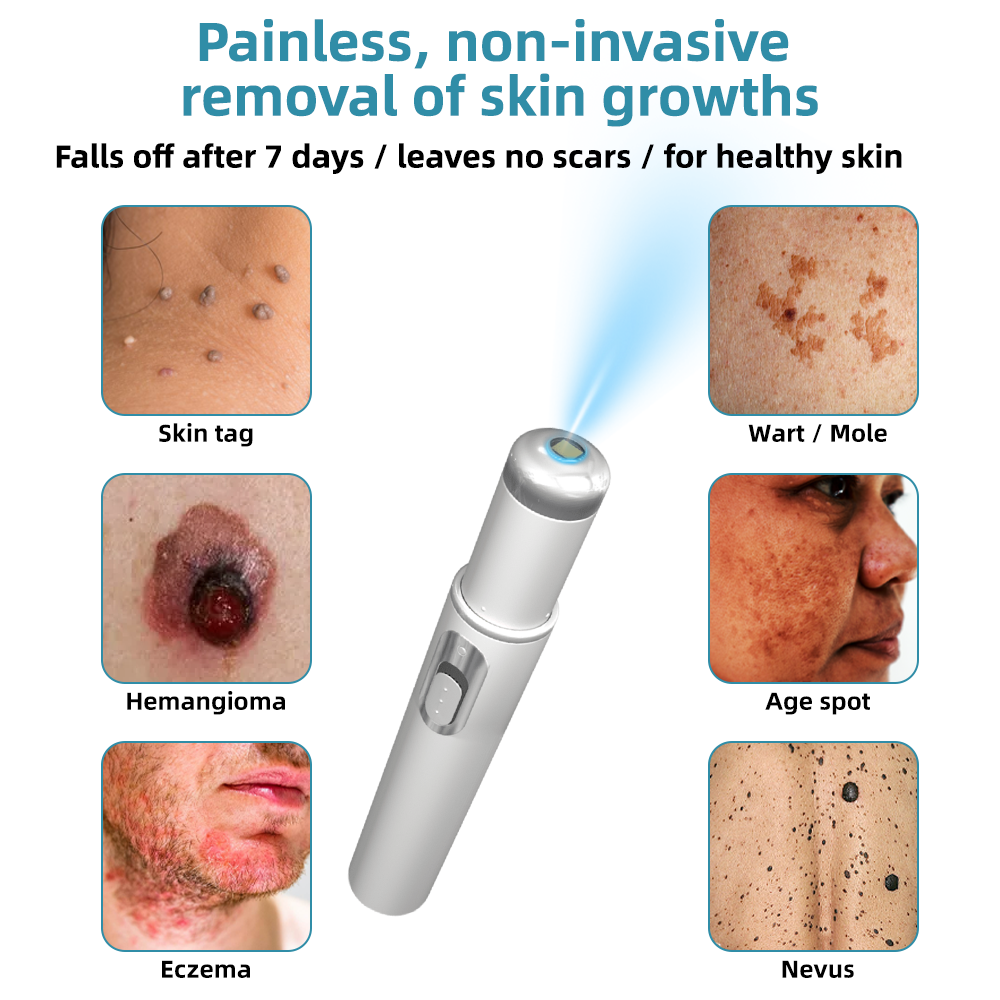 CO2 Laser Pen for Skin Blemish Removal – At-Home Precision Spot Treatment