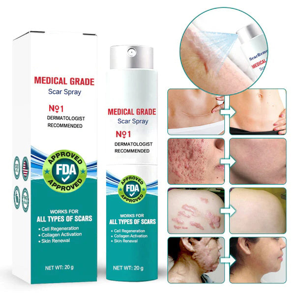 ScarSpray™ – Soothes Irritated, Sensitive Skin Quickly and Effectively [50% Off]