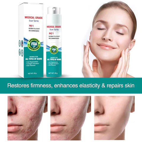 ScarSpray™ – Soothes Irritated, Sensitive Skin Quickly and Effectively [50% Off]